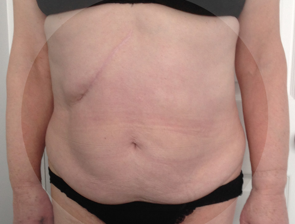 Photo of client before treatment.
